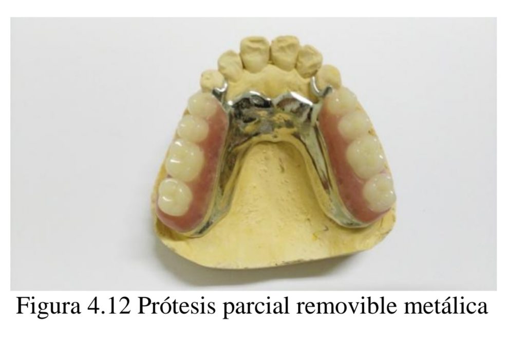Mccracken Protesis Parcial Removible 11 Edicion www.laguiadelprotesico.site